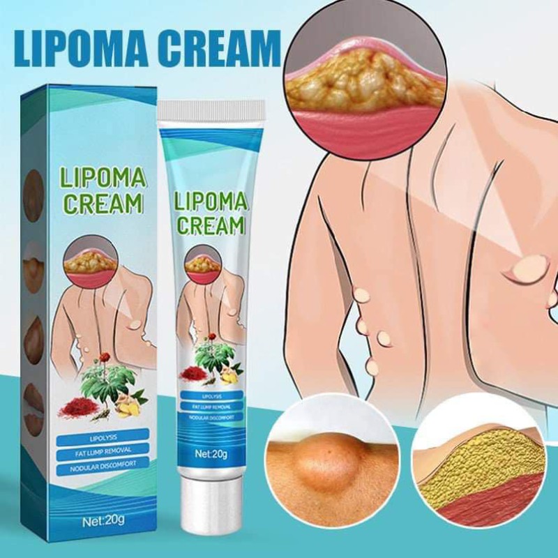 ৩ পিছ LIPOMA CREAM - অপারেশন ছাড়া আজই আপনার লাইপোমা ভালো করুন