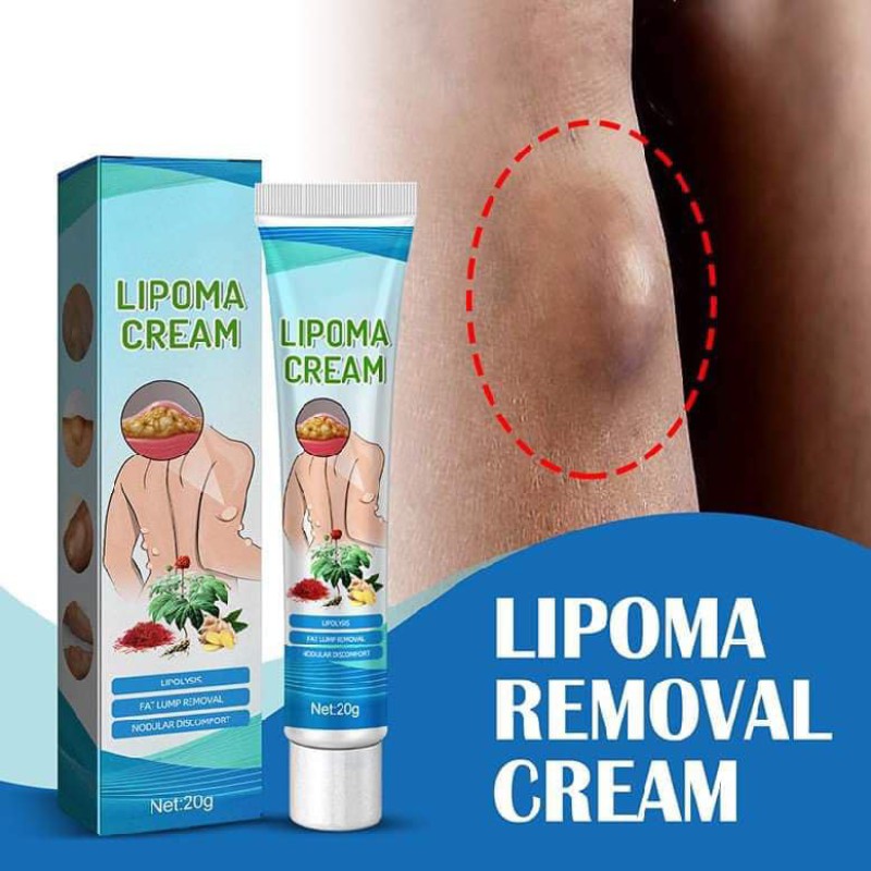 ৩ পিছ LIPOMA CREAM - অপারেশন ছাড়া আজই আপনার লাইপোমা ভালো করুন